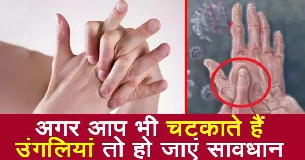 उंगलियां चटकाने की अगर है आदत तो सावधान, हो सकती है ये गंभीर बीमारी उंगलियां चटकाने की अगर है आदत तो सावधान, हो सकती है ये गंभीर बीमारी