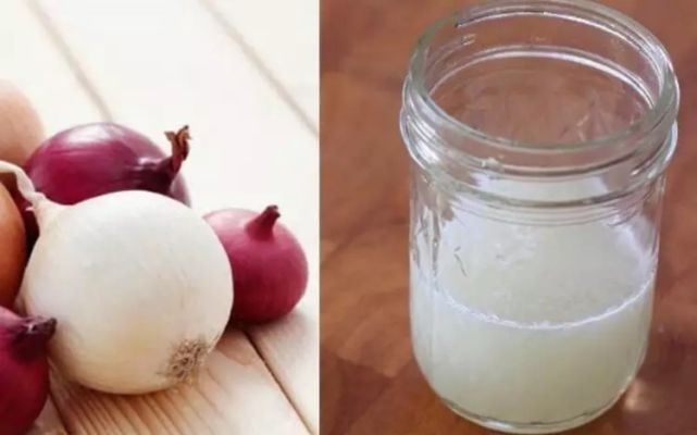 मासिक धर्म के दर्द को मिनटों में दूर करता है प्याज का रस, जानें आश्चर्यजनक फायदे - Kalyan Ayurved | DailyHunt