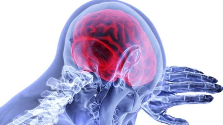 PSP: एक जटिल मस्तिष्क रोग - Yuva laiphastail | DailyHunt