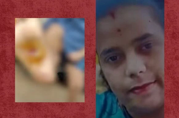 SHOCKING : ಇವಳೆಂಥಾ ತಾಯಿ!? ತುಂಟಾಟ ಮಾಡಿದ್ದಕ್ಕೆ ಮಗುವಿಗೆ ಕಾದ ಕಬ್ಬಿಣದಿಂದ ಬರೆ ಹಾಕಿದ ಅಮ್ಮ