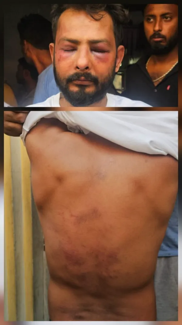 विहिप नगर अध्यक्ष अमित वर्मा पर जानलेवा हमला, गंभीर रूप से घायल