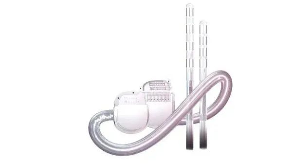 Aster Medcity Kochi becomes first in India to launch "Smart" Adaptive DBS for parkinson's disease