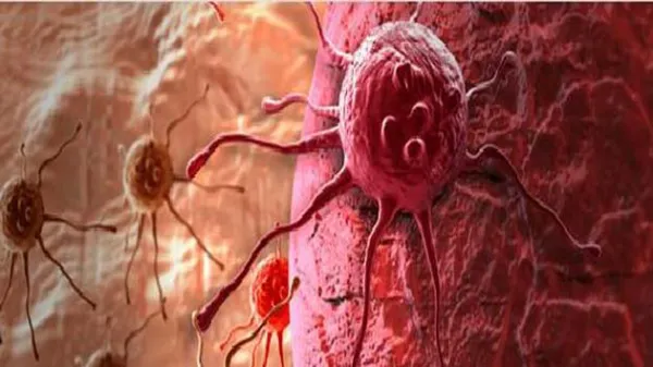 Russian scientists develop new method of curing cancer in scientific breakthrough