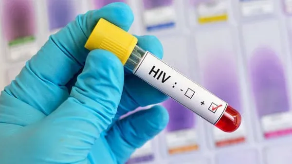 At 0.44%, Karnataka's HIV prevalence above national average 0.2%