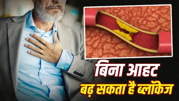 साइलेंट हार्ट डिजीज.. क्या बिना लक्षणों के भी हो सकती है आर्टरी में ब्लॉकेज?