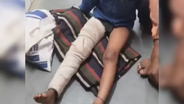 छतरपुर में हैवानियत! स्कूल बैग न लाने पर टीचर ने 5 साल के बच्चे को जमीन पर पटका, पैर टूटा