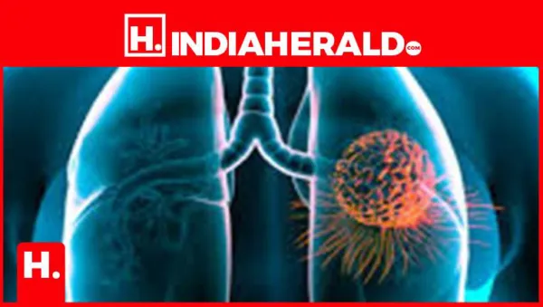 Breast Cancer Lung Metastasis: Understanding Why Breast Cancer Spreads to the Lungs