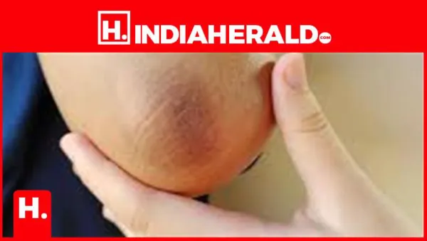 Have Dark Elbows? Here's How to Restore Your Natural Skin Colour