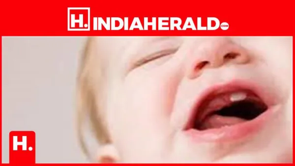 Effective Ways to Alleviate Teething Pain in Babies
