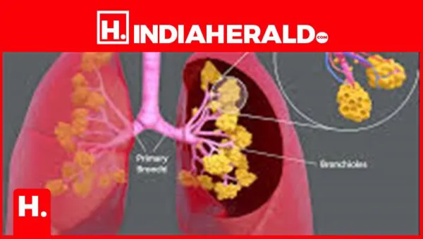 Lung Detox Tips: When Lungs Feel Weakened Due to Smoking