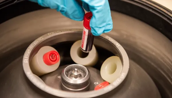 వేకువనే ప్రొటీన్ తో చక్కెర కంట్రోల్