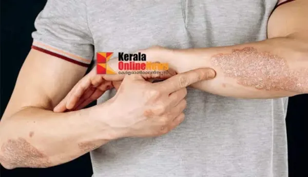 ത്വക്ക് രോഗങ്ങളെ പടിക്കുപുറത്താക്കാം