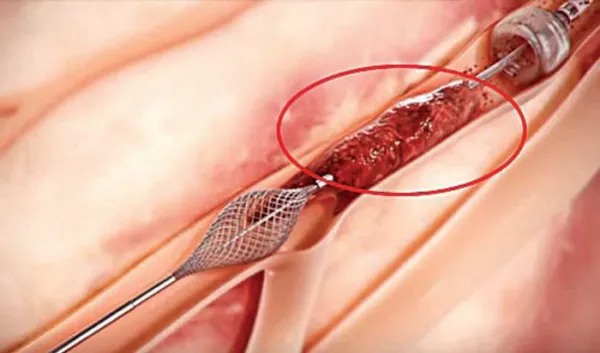 . म्हणून, वैद्यकीय क्षेत्रात आधुनिकतेची कदर व्हावी