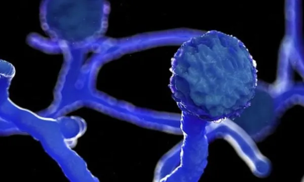 ಬ್ಲ್ಯಾಕ್ ಫಂಗಸ್ ಗೆ ಮಂಡ್ಯದಲ್ಲಿ ಮೊದಲ ಬಲಿ