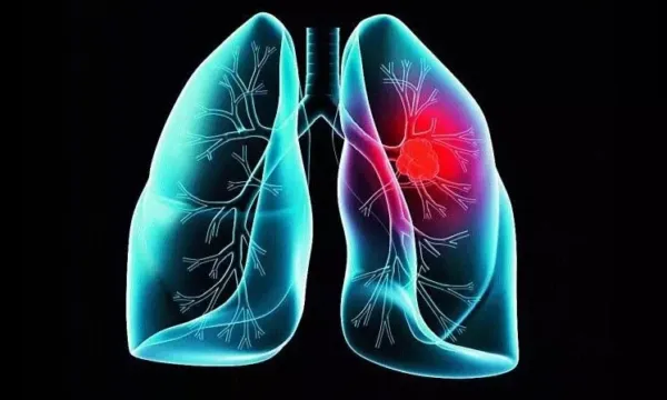 New Experimental Cancer Drug Removes Tumours' 'Invisibility Cloak ...