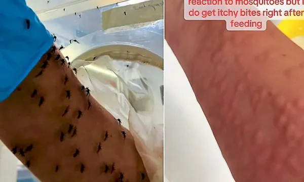 Scientist feeds own blood to lab mosquitoes in Melbourne, video goes viral