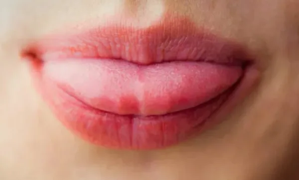 50 سالہ بیوہ خاتون کی عاشق نے زبان کاٹ دی۔ حیدرآباد میں سنسنی خیز واردات