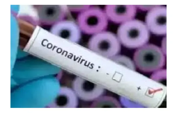 ಕಾಸರಗೋಡು: ಜಿಲ್ಲೆಯಲ್ಲಿ ಶನಿವಾರ 117 ಮಂದಿಯಲ್ಲಿ ಹೊಸದಾಗಿ ಕೋವಿಡ್ ವೈರಸ್ ಪತ್ತೆ