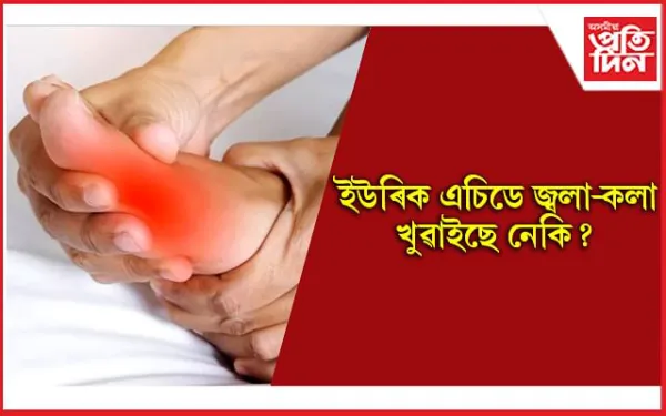 ইউৰিক এচিড নিয়ন্ত্ৰণত ৰাখিবলৈ খাওঁক এইসমূহ শুকান ফল