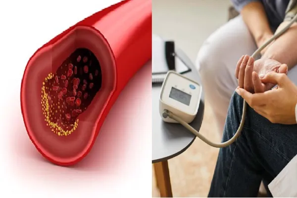 આ 5 ઉપાયોથી એક સાથે કંટ્રોલ થશે તમારુ High BP અને Cholesterol, ડોક્ટરનો આ ઉપાય બચાવી લેશે તમારો જીવ