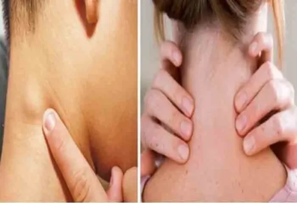 Thyroid & Food | ആരോഗ്യം നിയന്ത്രിക്കുന്നതിന് സമീകൃതാഹാരം പ്രധാനം; തൈറോയ്ഡ് രോഗികള്‍ പോഷകങ്ങള്‍ അടങ്ങിയ ഈ ഭക്ഷണങ്ങള്‍ ഡയറ്റില്‍ ഉള്‍പെടുത്താന്‍ മറക്കരുത്!