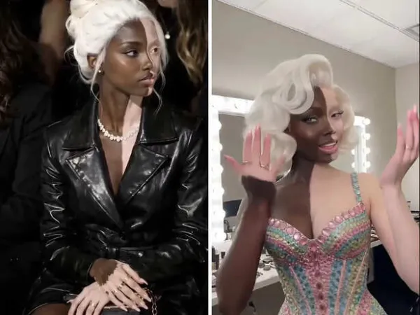 Who is Eva Delonne? Viral 'vitiligo model' takes over the internet after mysterious New York fashion show appearance as stunned netizens call her 'a symbol of beauty'
