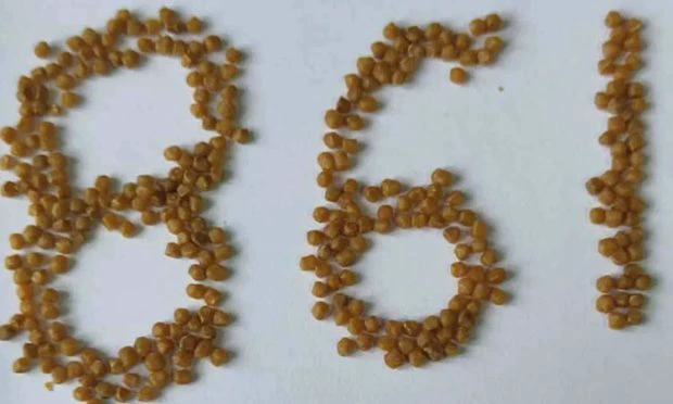 ಮಹಿಳೆ ಪಿತ್ತಕೋಶದಿಂದ 861 ಕಲ್ಲು ಹೊರ ತೆಗೆದ ವೈದ್ಯರು!