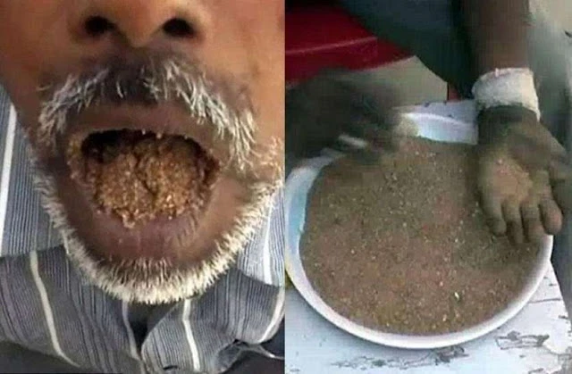 For the past 28 years, this person is alive only by eating mud, the doctors are also surprised