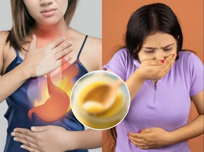 क्या आप एसिडिटी की समस्या से परेशान हैं? आयुर्वेदिक विशेषज्ञ की सलाह के अनुसार एक आदत एसिडिटी की समस्या को कम करेगी क्या आप एसिडिटी की समस्या से परेशान हैं? आयुर्वेदिक विशेषज्ञ की सलाह के अनुसार एक आदत एसिडिटी की समस्या को कम करेगी