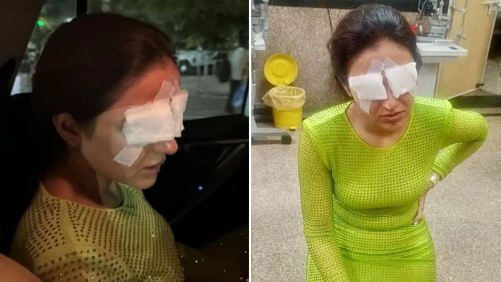 SHOCKING : 1 गलती के कारण जैस्मिन भसीन की डैमेज हुई आंखें, दिखना भी बंद