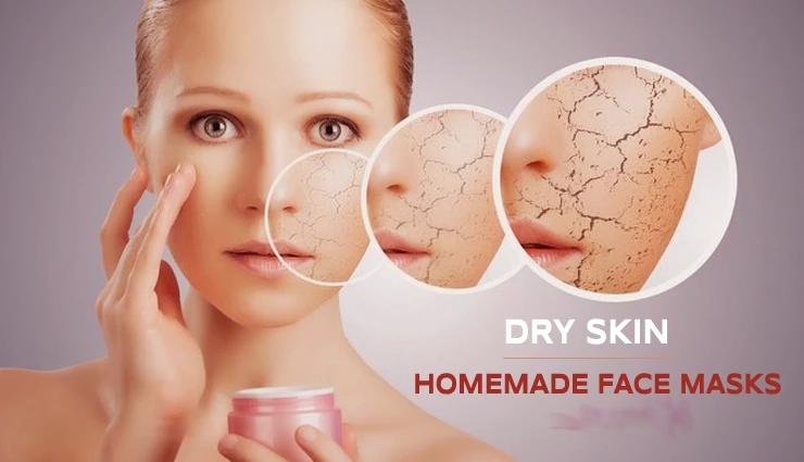 5 DIY Homemade Face Masks To Get Rid Of Dry Skin
