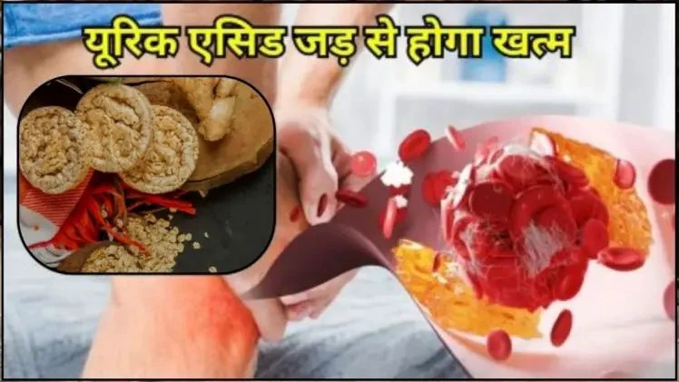 ५ रुपये की चीज़ यूरिक एसिड का करेगी सफाया, गठिया से मिलेगी राहत ५ रुपये की चीज़ यूरिक एसिड का करेगी सफाया, गठिया से मिलेगी राहत