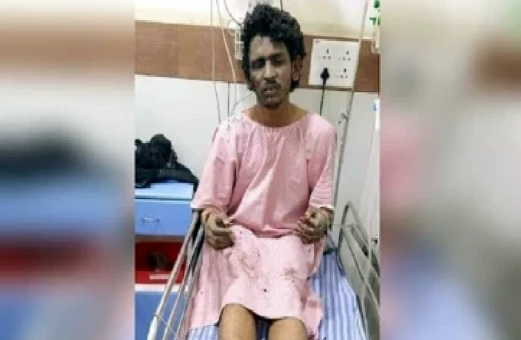 ಕುಕ್ಕರ್ ಬಾಂಬ್ ಸ್ಪೋಟ ಪ್ರಕರಣ : ಮುಂದಿನ ವಾರ ಆರೋಪಿ ಶಾರೀಕ್ ಆಸ್ಪತ್ರೆಯಿಂದ ಡಿಸ್ಚಾರ್ಜ್