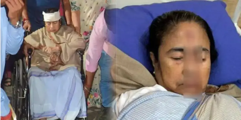 முகத்தில் வழிந்த ரத்தம்.. பதறிய தலைவர்கள்.. பத்திரமாக வீடு திரும்பிய மம்தா.!