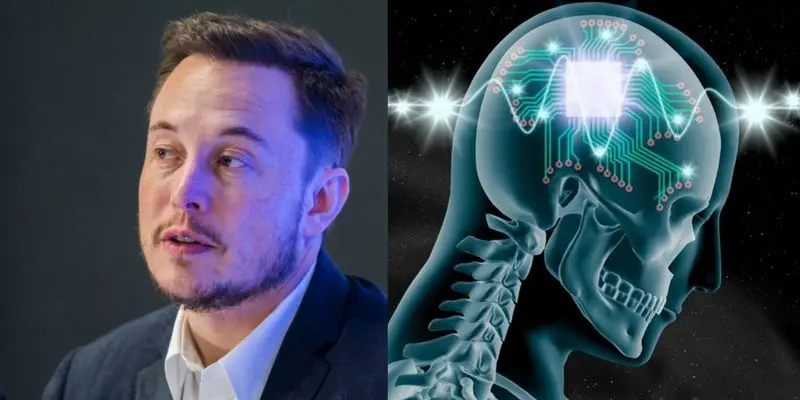 Neuralink's first user: Life after the brain implant