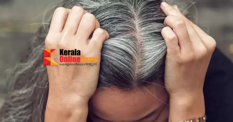 അകാലനര ആത്മവിശ്വാസം ഇല്ലാതാക്കുന്നുവോ ? വീട്ടില്‍ തന്നെയുണ്ട് പരിഹാരം
