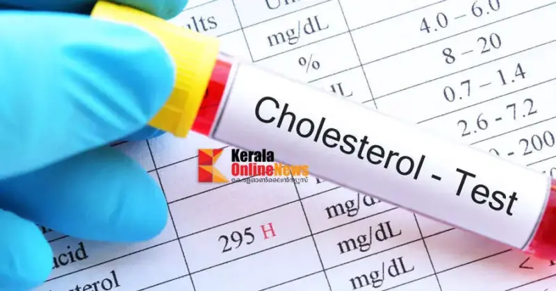 കൊളസ്ട്രോള്‍ കുറയ്ക്കാൻ കഷ്ടപ്പെടേണ്ട; മരുന്നില്ലാതെ നിയന്ത്രിക്കാൻ ഇതാ ഒരു മാന്ത്രിക വഴി