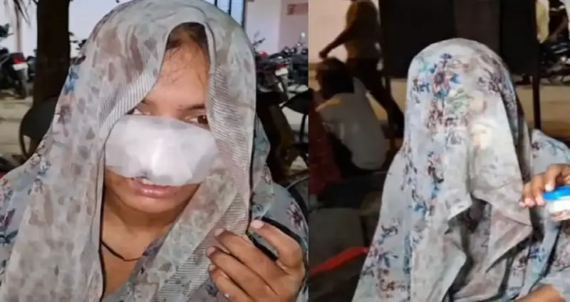 Horror in Hamirpur: Man Bites Off Wife's Nose and Cheeks in Shocking Fit of Rage!