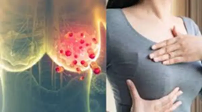 Breast Cancer Lung Metastasis: Why does breast cancer spread to the lungs? Research reveals the tumour's 'support system.'