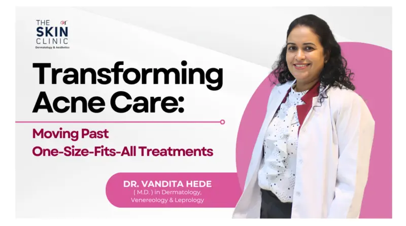 Redefining Acne Treatment: Moving Beyond One-Size-Fits-All Solutions
