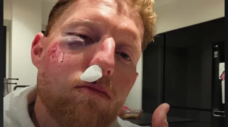 England's Ben Stokes Speaks on Near-Fatal Injury: 'I Might Not Be Here'