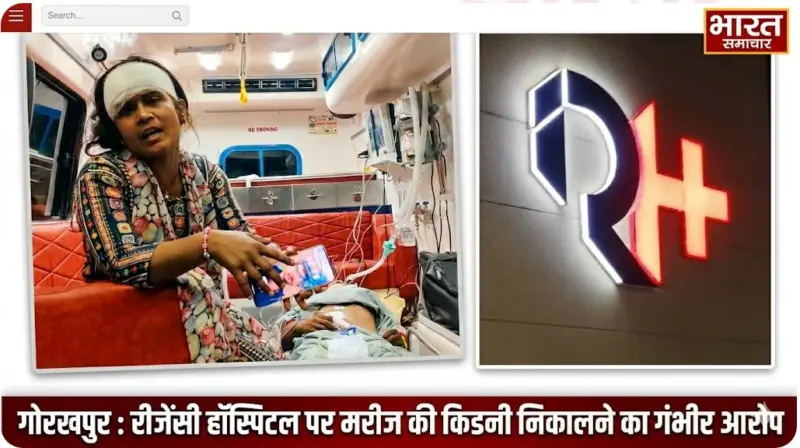 गोरखपुर : सिर में लगी थी चोट तो पेट का ऑपरेशन क्यों ? इलाज के दौरान निकाली किडनी, परिजनों का रीजेंसी हॉस्पिटल पर गंभीर आरोप