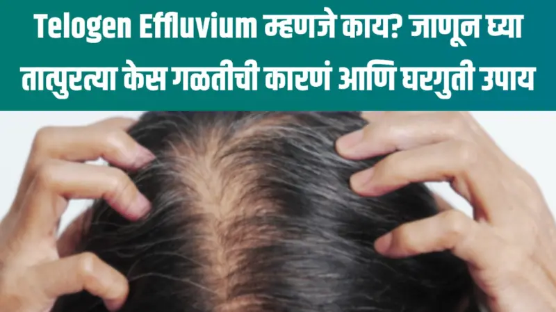 Telogen Effluvium म्हणजे काय? जाणून घ्या तात्पुरत्या केस गळतीची कारणं आणि घरगुती उपाय