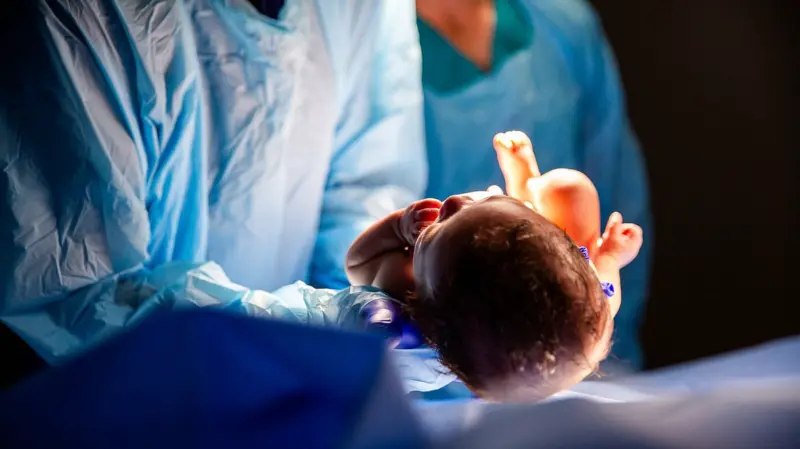 Dissecting fear: Why women are still scared of C-sections?