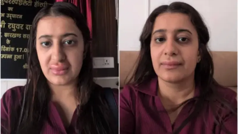 "உயிருக்கே ஆபத்தாகி இருக்கும்!". மதிய உணவு சாப்பிட்ட சில மணிநேரத்தில் வீங்கிய உதடு.. 2 வயது குழந்தையும் பாதிப்பு.. வந்தே பாரத்தில் பரபரப்பு..!