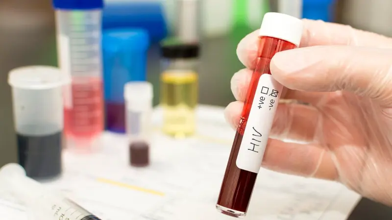 Singapore recommends adults to test for HIV once in lifetime