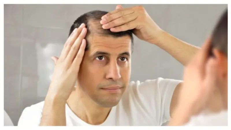 ಅತಿಯಾಗಿ ತಲೆಕೂದಲು ಉದುರುತಿದ್ರೆ, ನಿವಾರಣೆಗೆ ಇಲ್ಲಿದೆ ಸುಲಭ ಉಪಾಯ