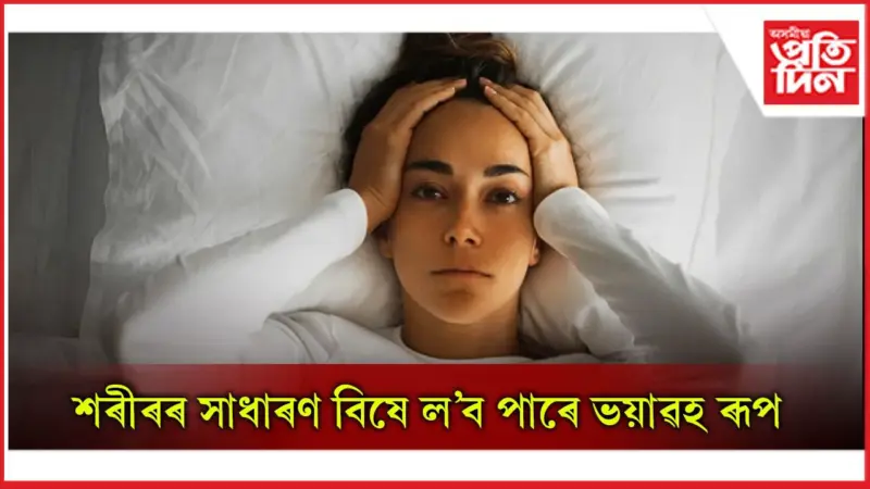 সাৱধান ! ভাগৰ লগাটোও বেমাৰৰ লক্ষণ