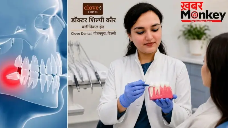 Wisdom Teeth: अक्ल दाढ़ निकालनी चाहिए या रहने दें? डेंटिस्ट से जानें
