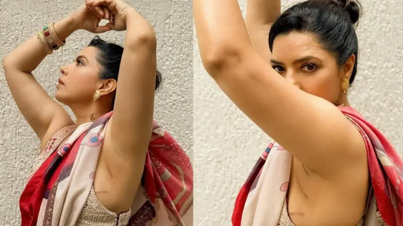 Cancer Survivor: బ్రెస్ట్ క్యాన్సర్‌ను జయించిన నటి.. ఒంటిపై ఆ మహమ్మారి మిగిల్చిన గాయాలను చూపిస్తూ పోస్ట్..